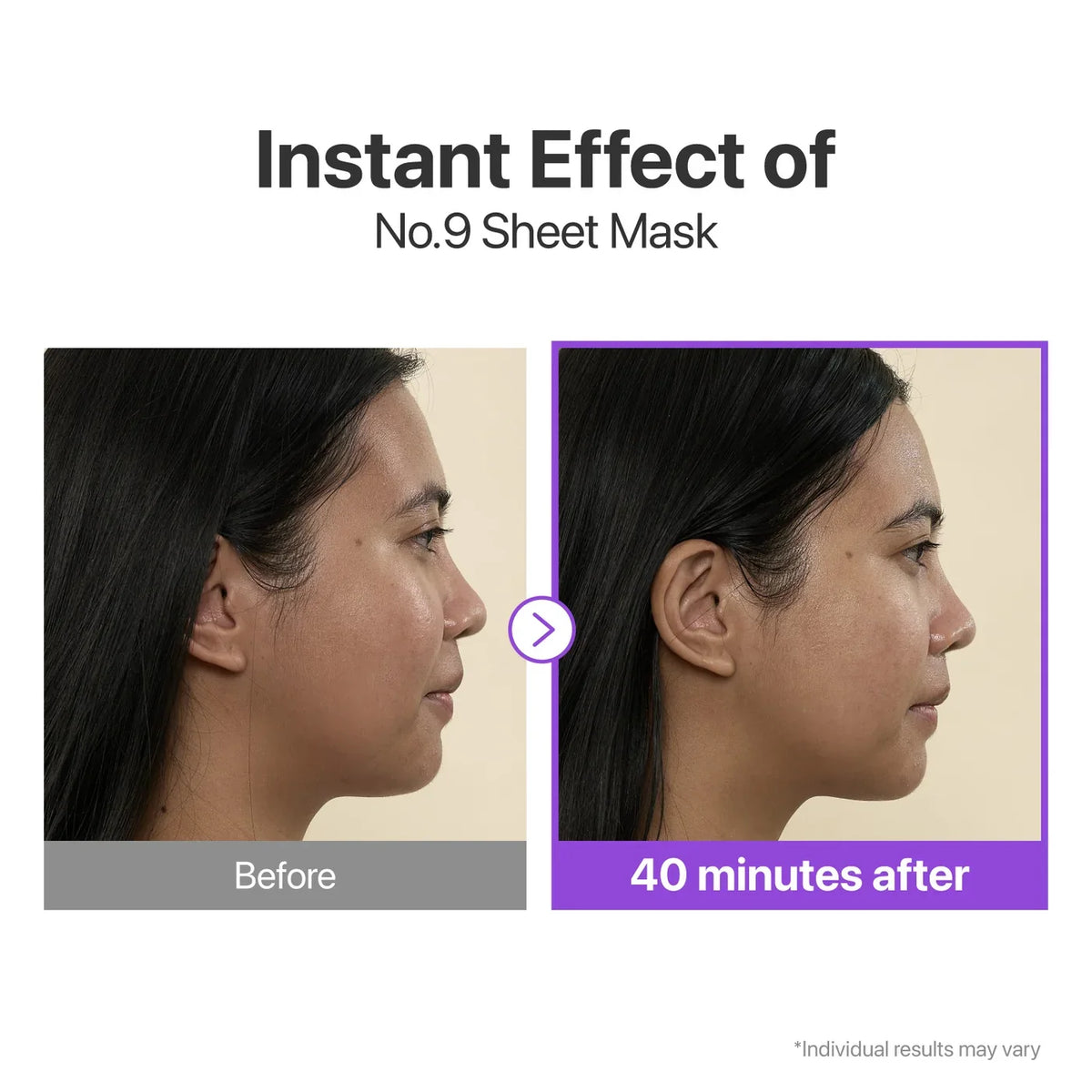 Numbuzin No.9 NAD+ BIO Lifting-sil Full Face Mask – Firming & Lifting Sheet Mask - 4Sheets + 1Sheet Lifting Band Gift