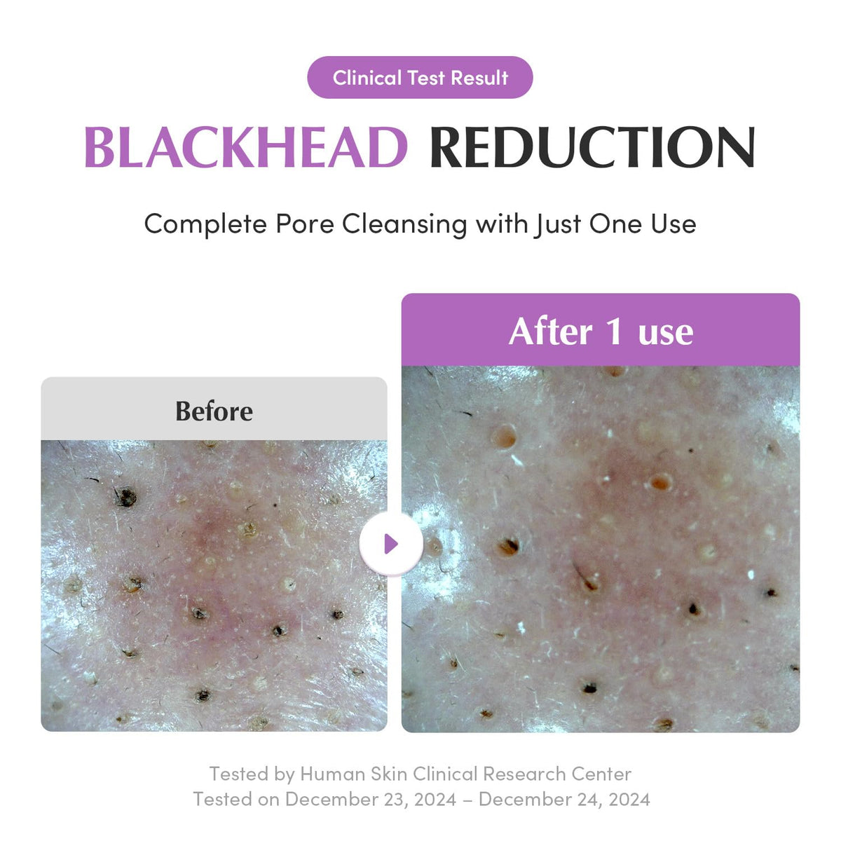 EQQUALBERRY Purple Rice Pore Purifying Pack Cleanser