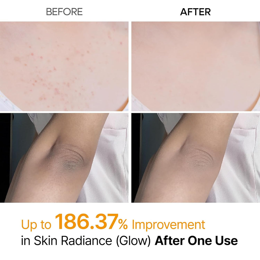 Dr.Melaxin Peel Shot Kojic Acid Turmeric Body Exfoliator Spray - 200ml