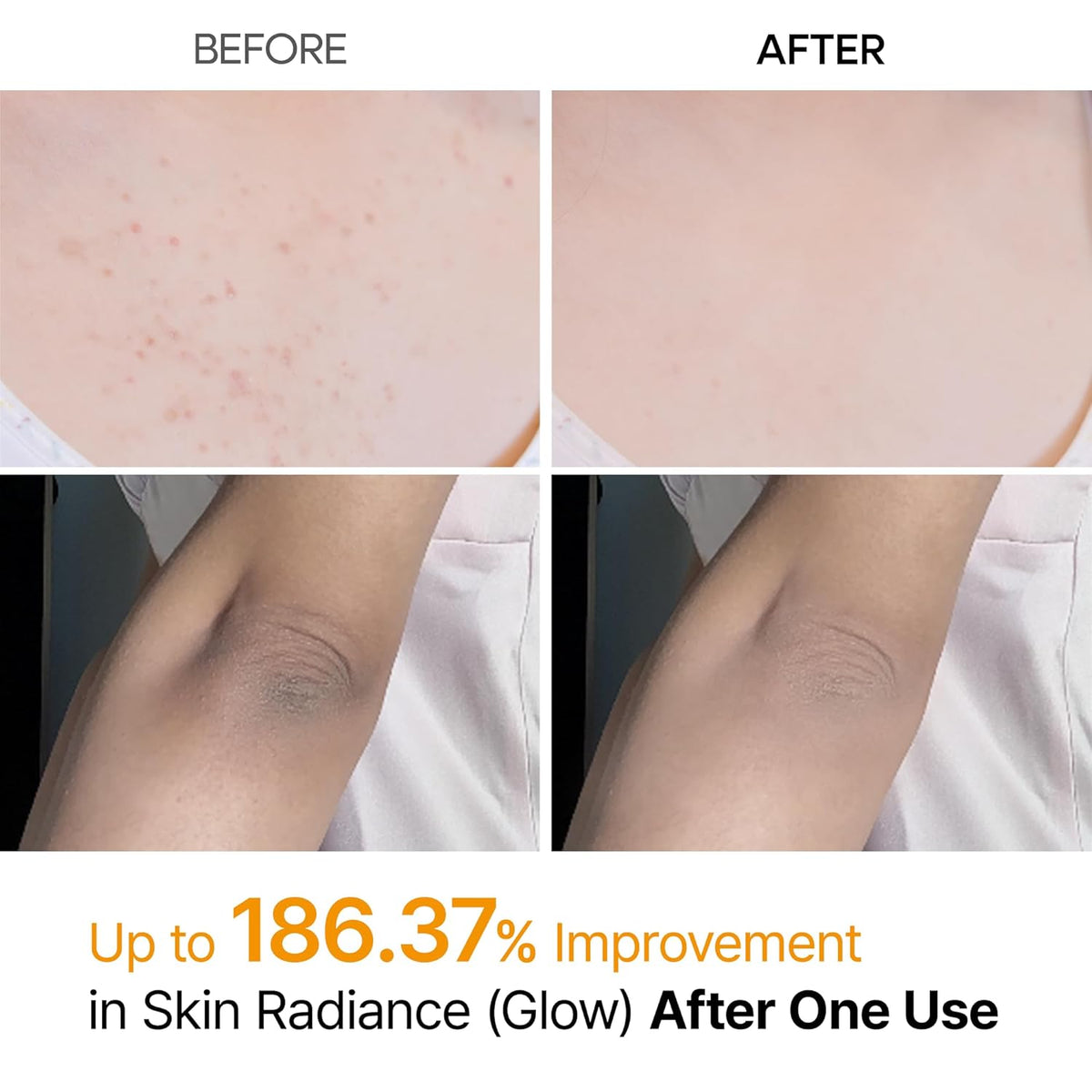 Dr.Melaxin Peel Shot Kojic Acid Turmeric Body Exfoliator Spray - 200ml