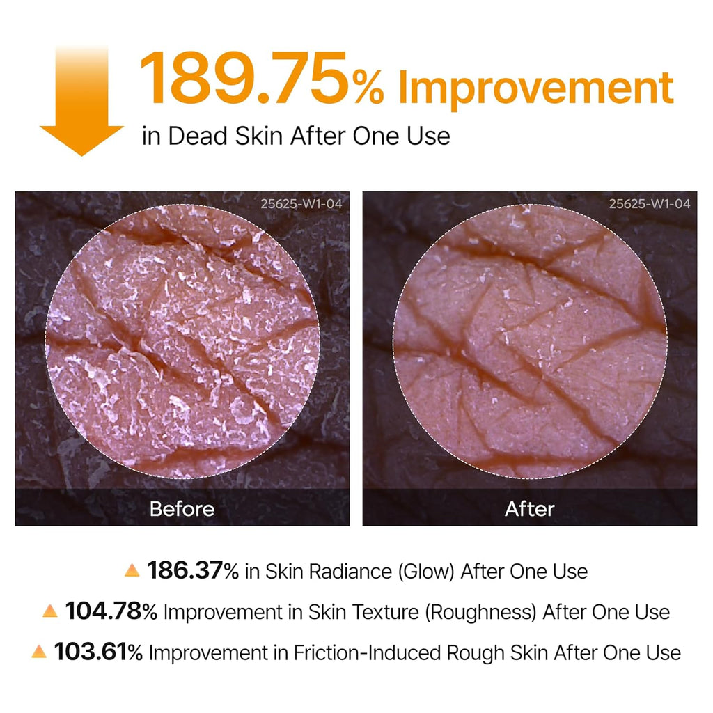 Dr.Melaxin Peel Shot Kojic Acid Turmeric Body Exfoliator Spray - 200ml