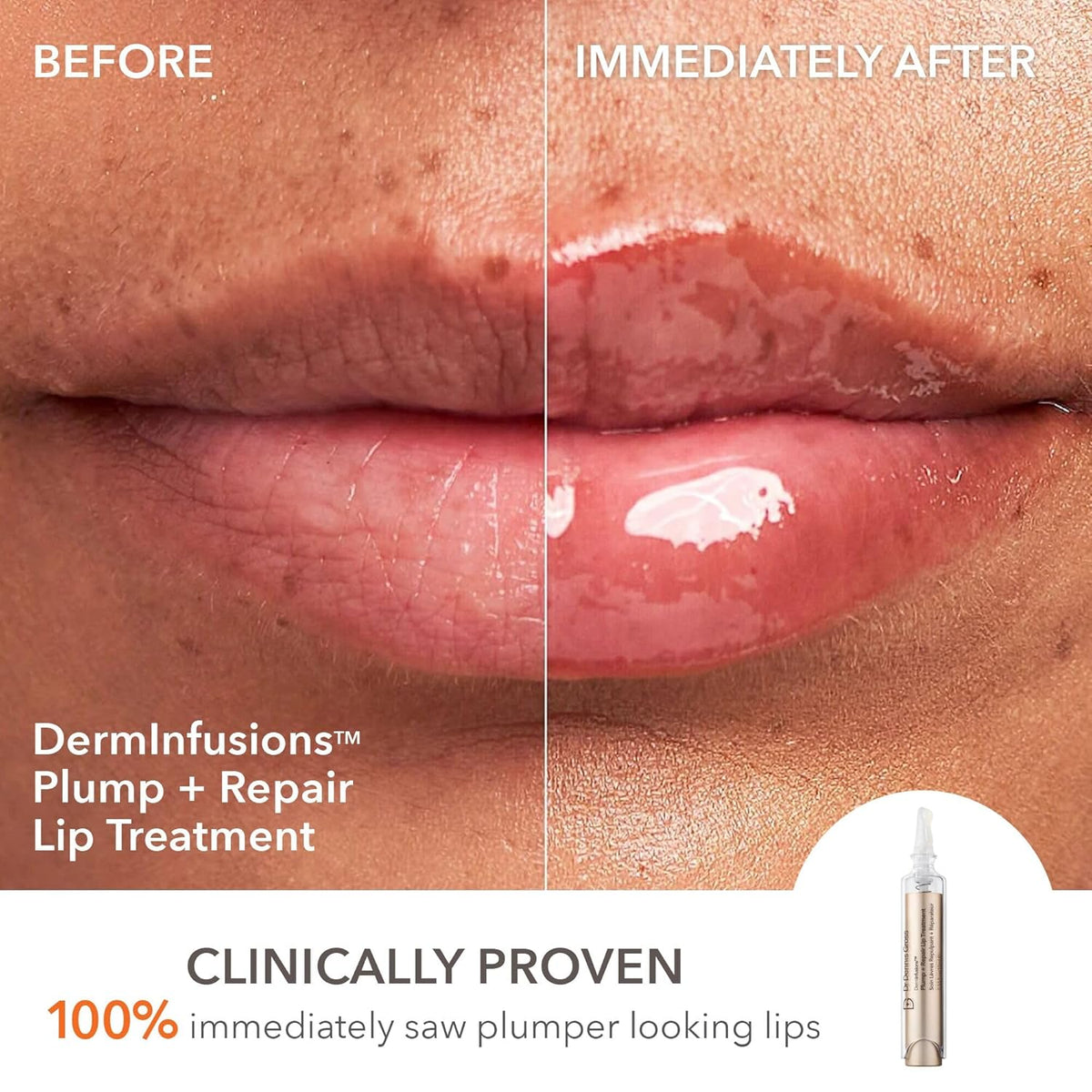 Dr. Dennis Gross DermInfusions 3D Plump, Fill & Repair Kit – Lip Treatment, Serum & Eye Mask