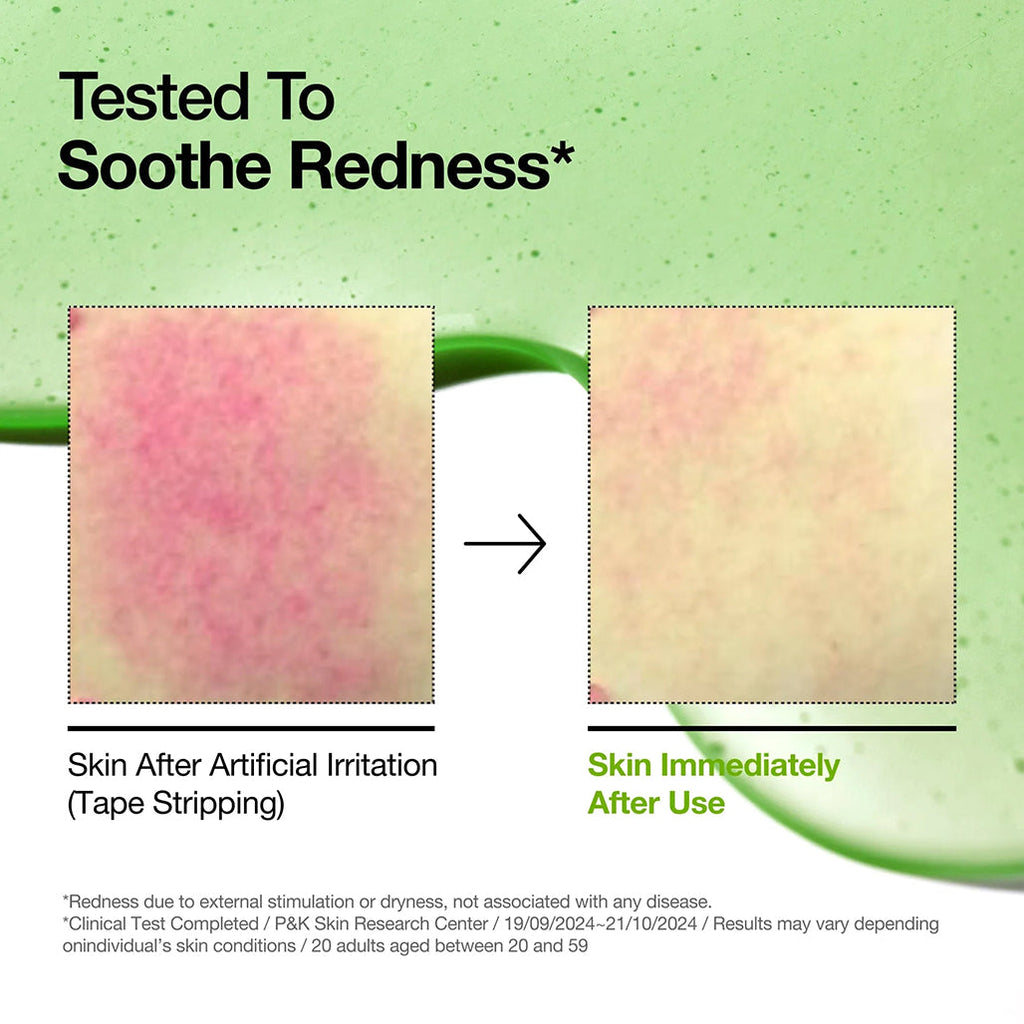 Anua Azelaic Acid 10+ - Hyaluron Redness Soothing Serum