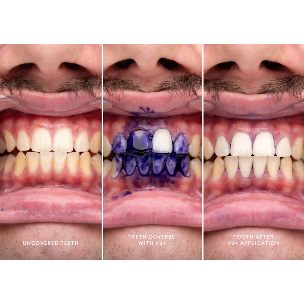 Hismile V34 Colour Corrector Serum