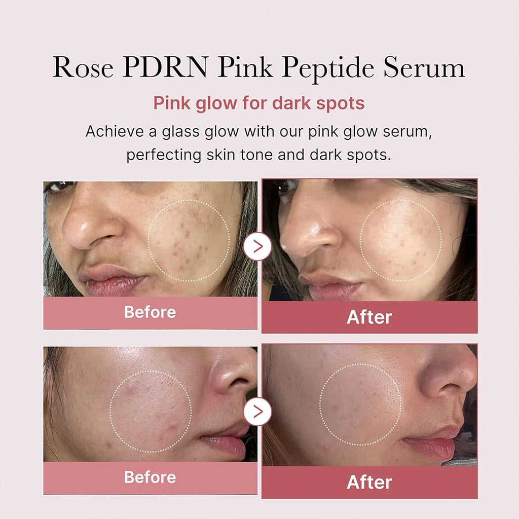 Medicube PDRN Pink Peptide Serum - 30ml