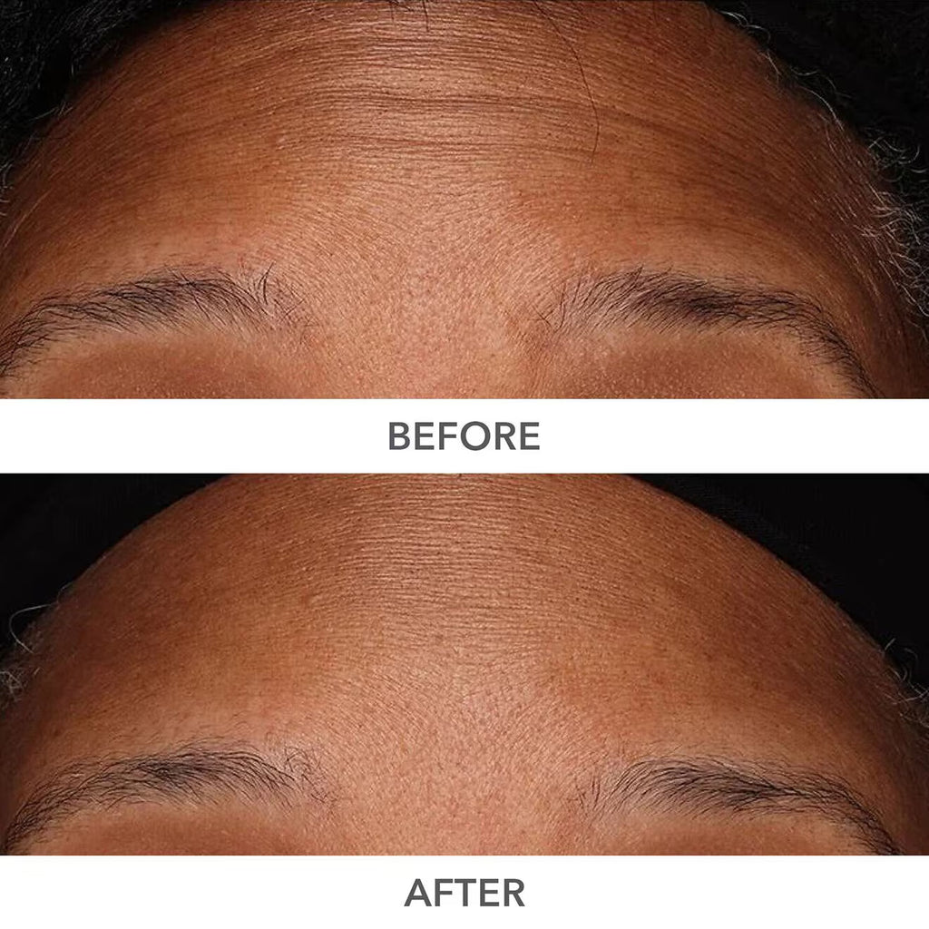 Dr. Dennis Gross DermInfusions 3D Plump, Fill & Repair Kit – Lip Treatment, Serum & Eye Mask