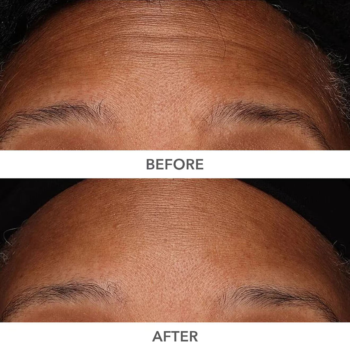 Dr. Dennis Gross DermInfusions 3D Plump, Fill & Repair Kit – Lip Treatment, Serum & Eye Mask
