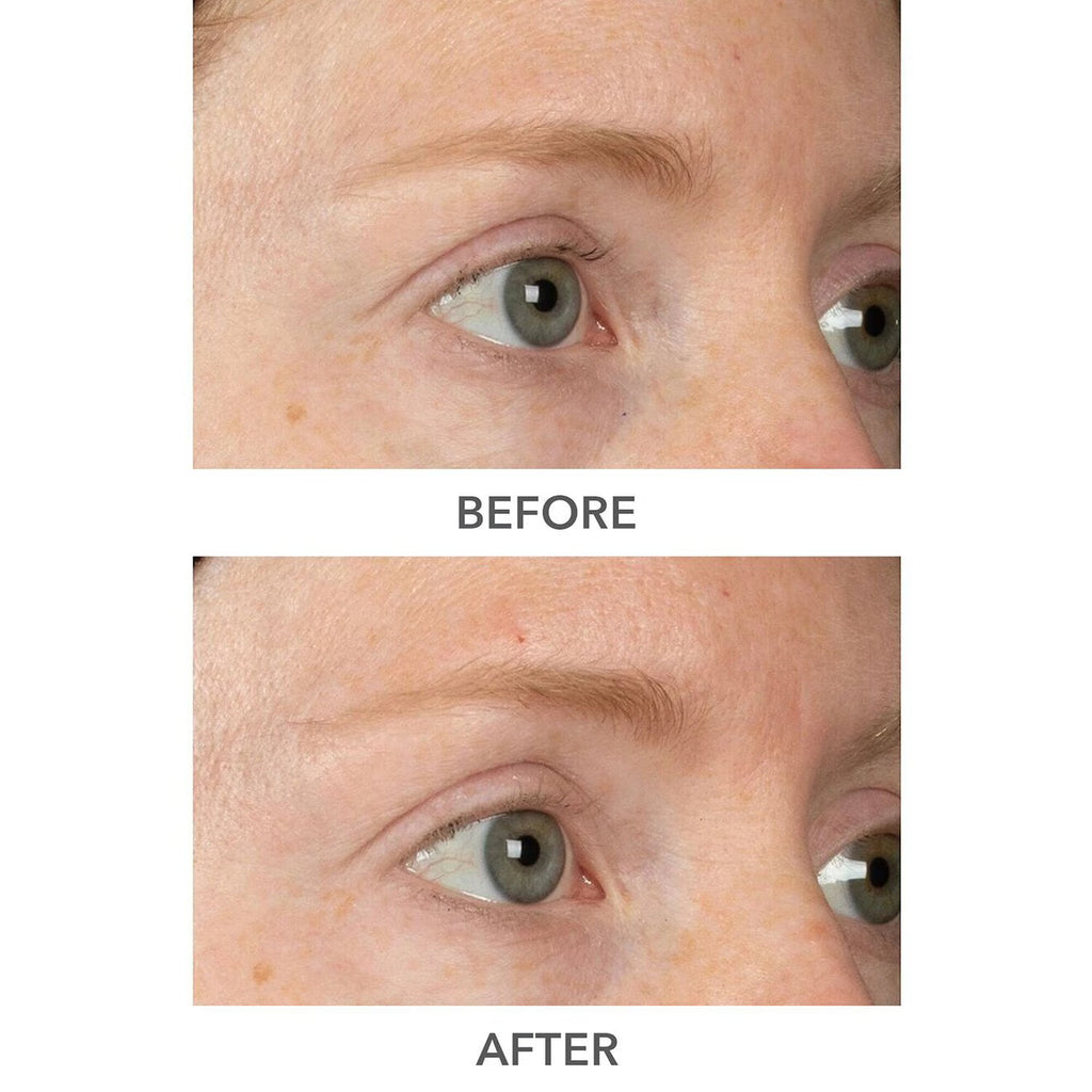 Dr. Dennis Gross DermInfusions 3D Plump, Fill & Repair Kit – Lip Treatment, Serum & Eye Mask