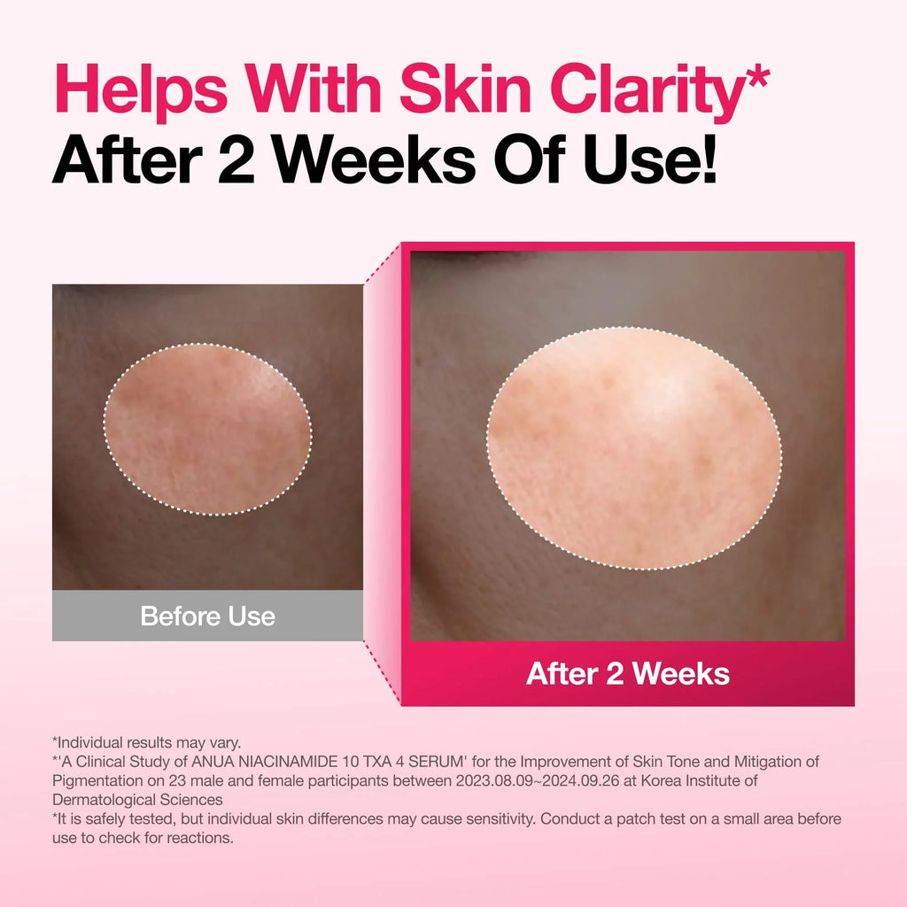 Anua Niacinamide 10% + TXA 4% Serum for Brightening & Dark Spot Care