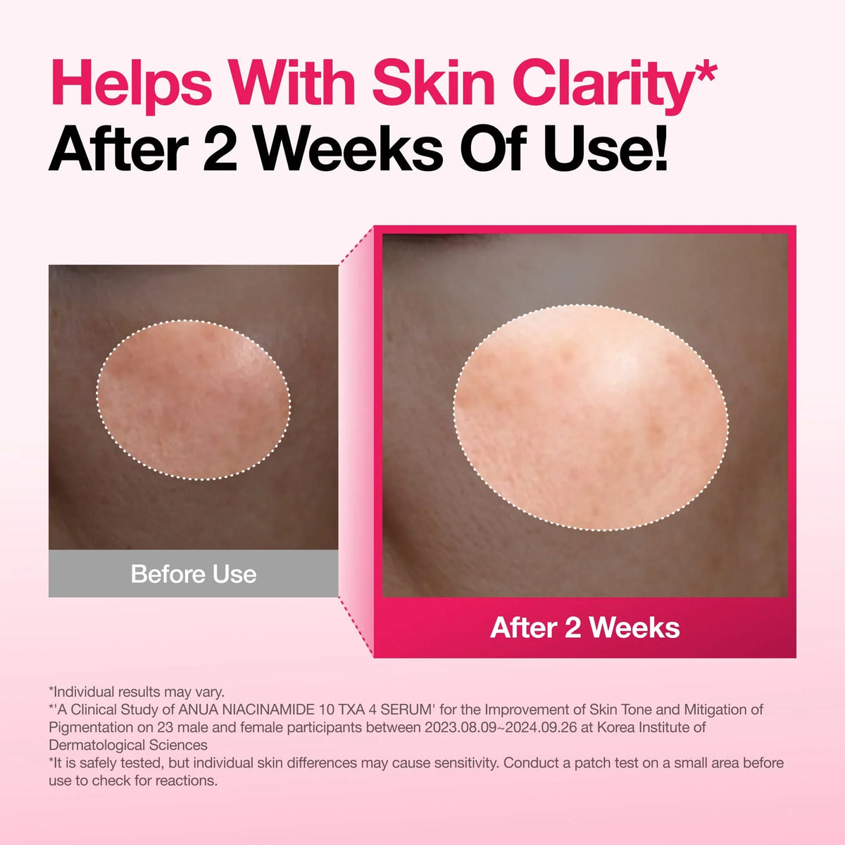 Anua Niacinamide 10% + TXA 4% Serum for Brightening & Dark Spot Care